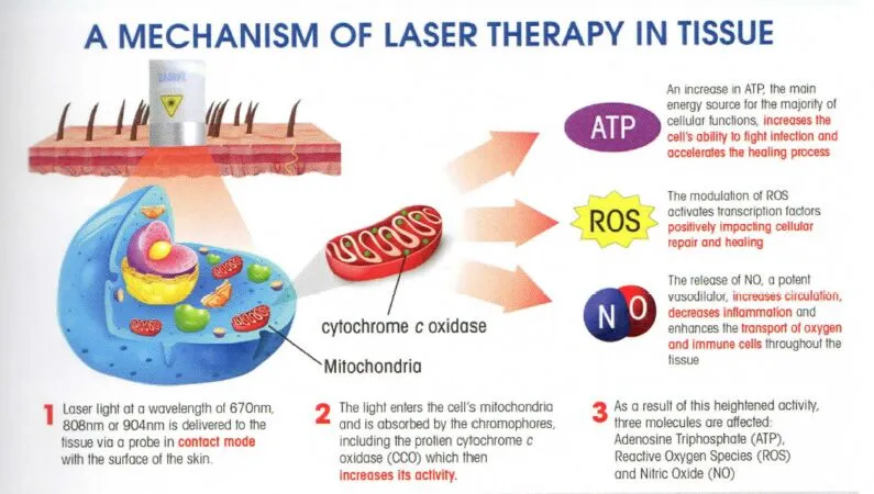 Photobiomodulation